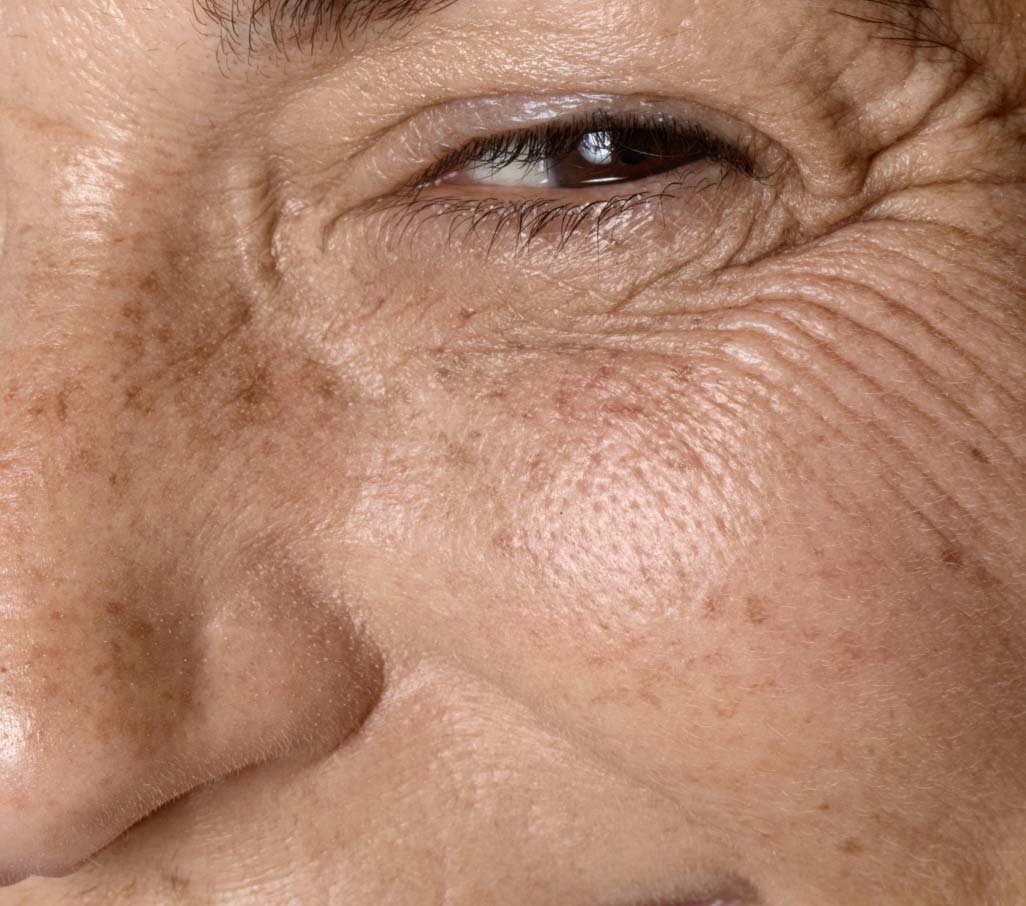 Tratamientos-Antiedad-y-Preventivos